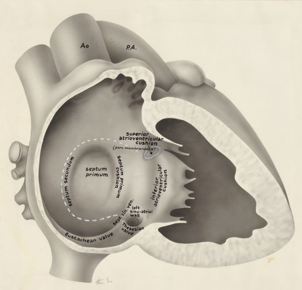 J Tinkelenberg, Embryonic heart