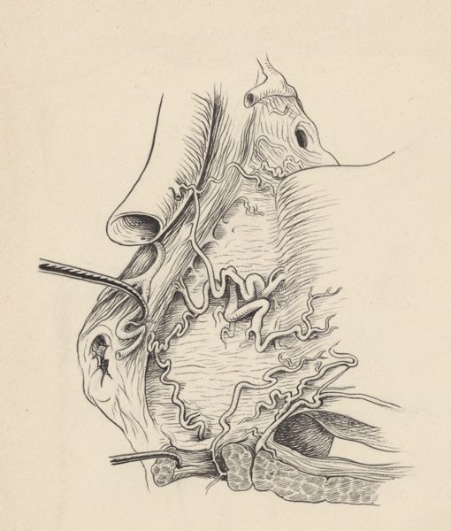 J Tinkelenberg, Part of the heart and circulatory system