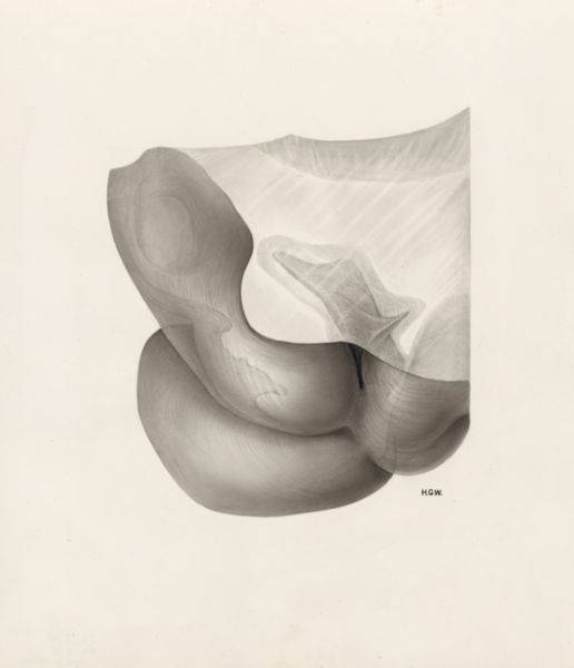 H.G Wetselaar, Embryonic tissue