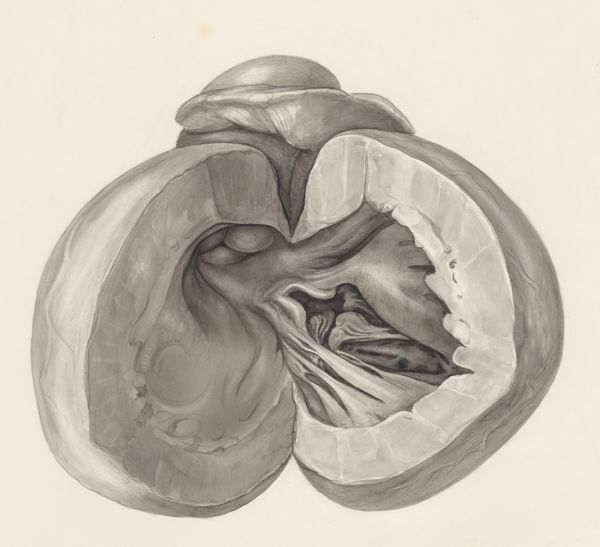 H.G Wetselaar, Heart