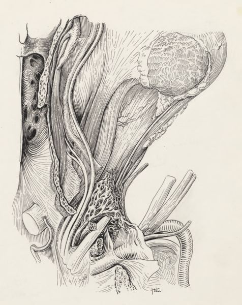 J Tinkelenberg, Circulatory system of the head