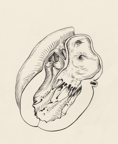 J Tinkelenberg, Cross section of a heart