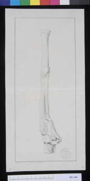 M Houtman, Pathology, fractures (Forearm)