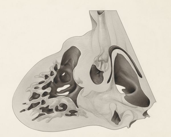 J Tinkelenberg, Cross section of embryonic tissue