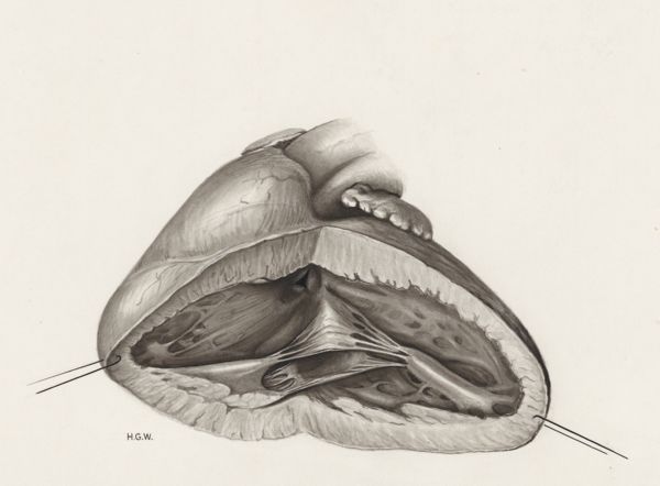 H.G Wetselaar, Heart