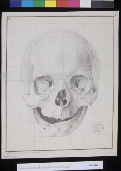 M Houtman, Pathology, fractures