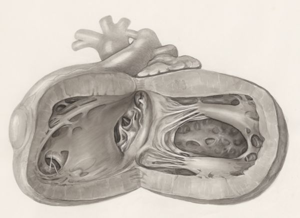 H.G Wetselaar, Heart
