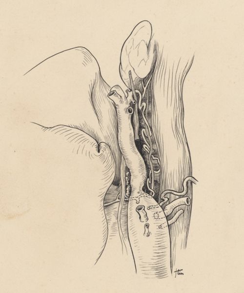 J Tinkelenberg, Part of the heart and circulatory system