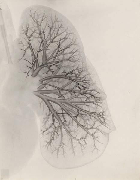 J Tinkelenberg, Bronchi