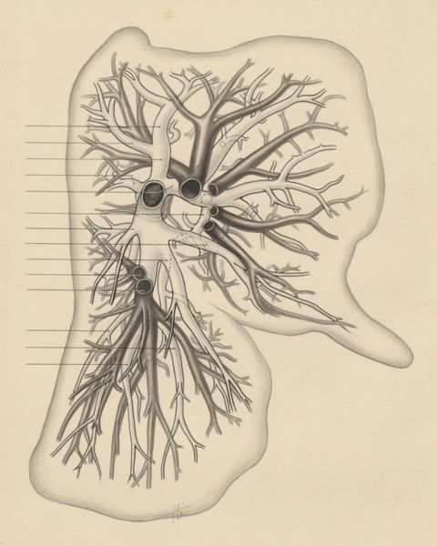J Tinkelenberg, Bronchi