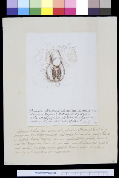 A Bonn, Genitals of a hermaphrodite