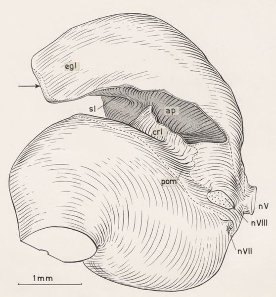 J Tinkelenberg, Reconstruction of the cerebellum
