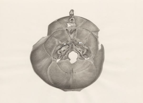 H.G Wetselaar, Deformed fetal skull, seen from below