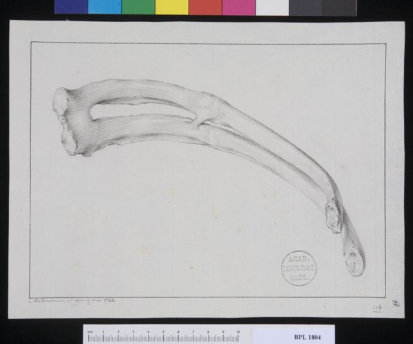 M Houtman, Pathology, fractures (Ribs)
