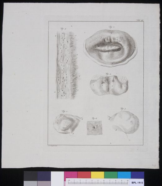 R Muys, Tissues of pregnant womb
