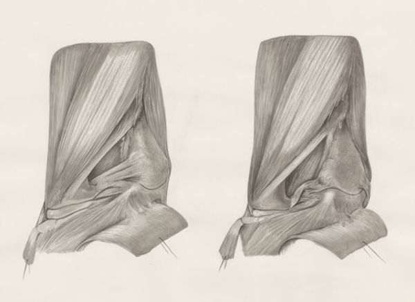 H.G Wetselaar, Muscular tissue of the upper extremities