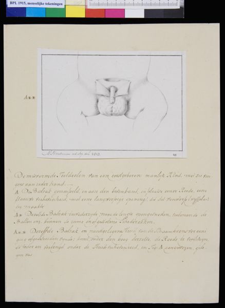 M Houtman, Genitals, hermaphrodite