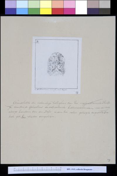M Houtman, Skull of a child, interior view