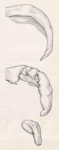 J Tinkelenberg, Reconstruction of the cerebellum