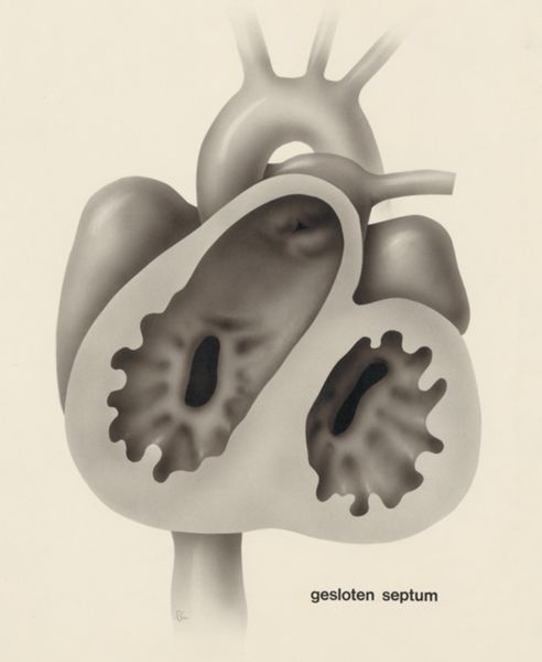 J Tinkelenberg, Embryonic heart