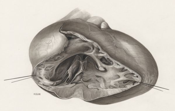H.G Wetselaar, Heart and adjacent organs