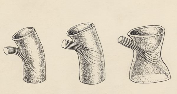 J Tinkelenberg, Part of the heart and circulatory system