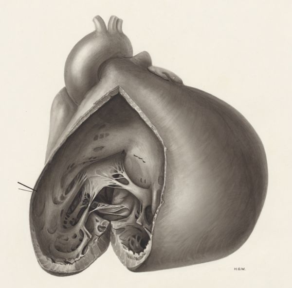 H.G Wetselaar, Heart and adjacent organs