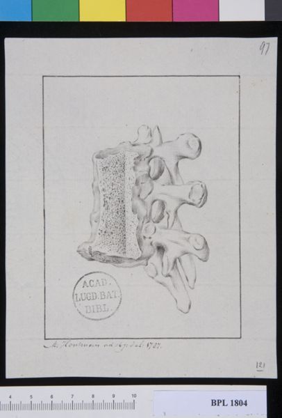 M Houtman, Pathology, fractures (Spine, cervical vertebrae)