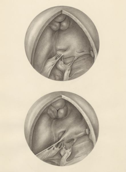 H.G Wetselaar, Two microscopic magnifications of parts of the heart
