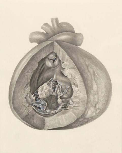 H.G Wetselaar, Heart