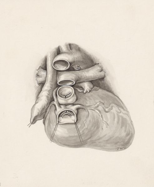 J Wetselaar-Whittaker, Cardiovascular system