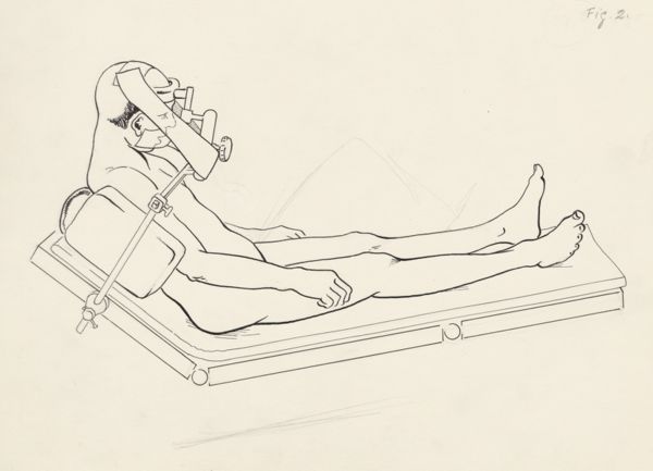 J Tinkelenberg, Neurosurgical Procedures