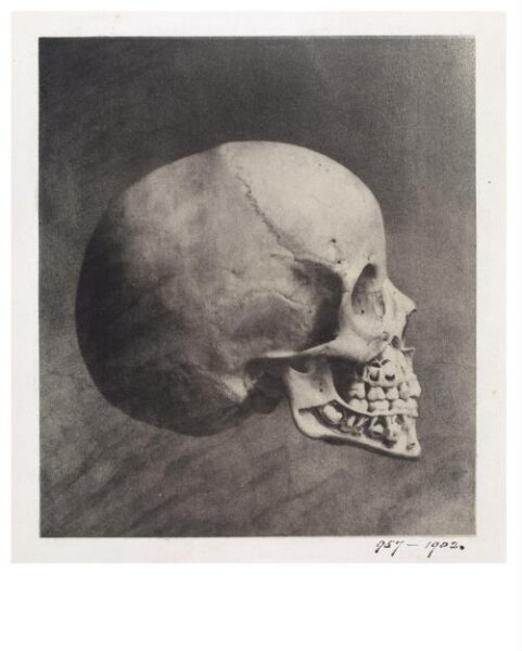 Unknown, Skull