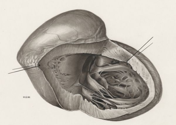 H.G Wetselaar, Heart and adjacent organs