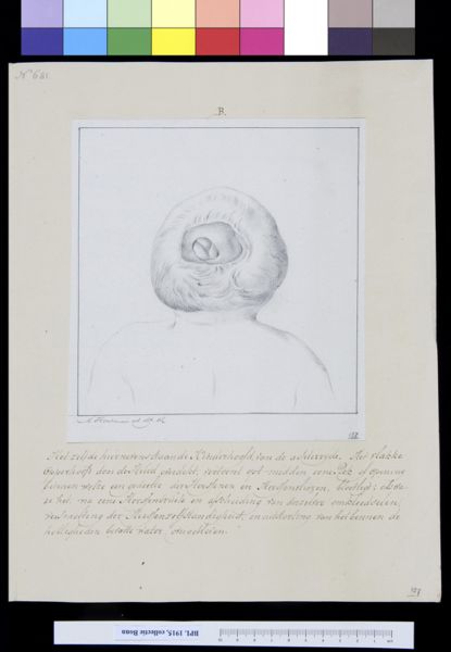 M Houtman, Deformed child, seen from behind
