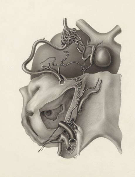 J Tinkelenberg, Nerves and other tissue of the neck and/or head