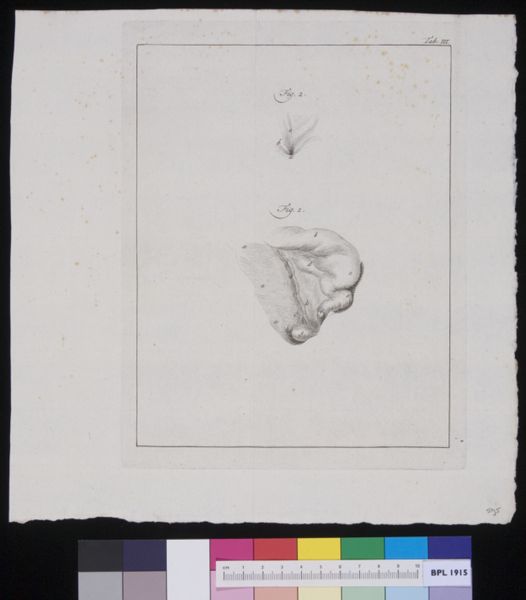 R Muys, Details of male urinary tract?