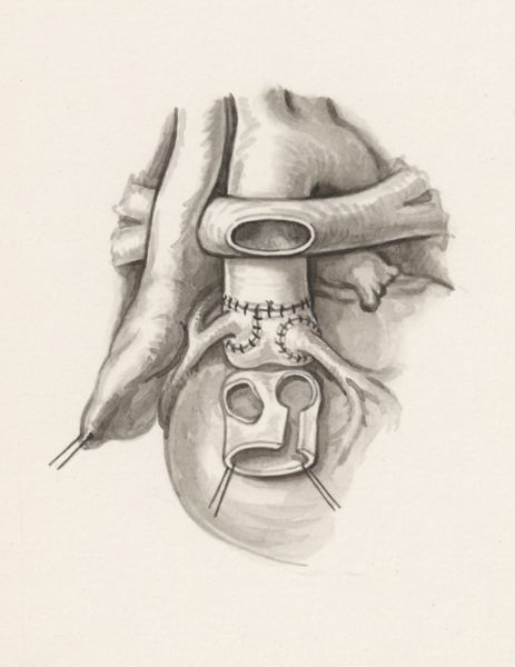 J Wetselaar-Whittaker, Cardiovascular system