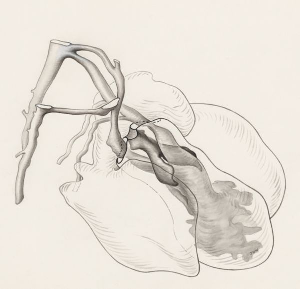 J Wetselaar-Whittaker, Tissue of the human embryo
