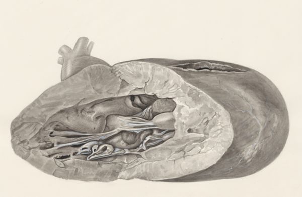 H.G Wetselaar, Heart