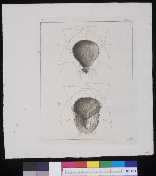 R Muys, Abdomen with position of womb
