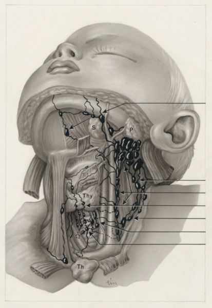 J Tinkelenberg, Neck surgery