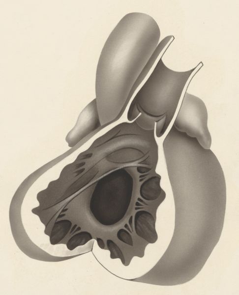 J Tinkelenberg, Heart