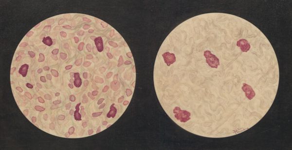 J Tinkelenberg, Microscopic views of the digestive system