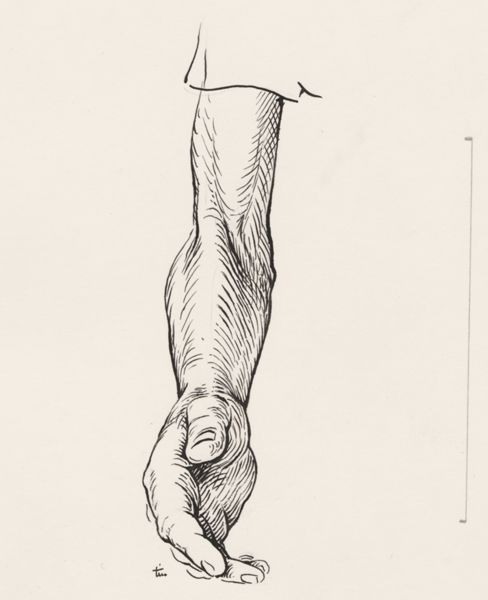J Tinkelenberg, Human forearm and hand