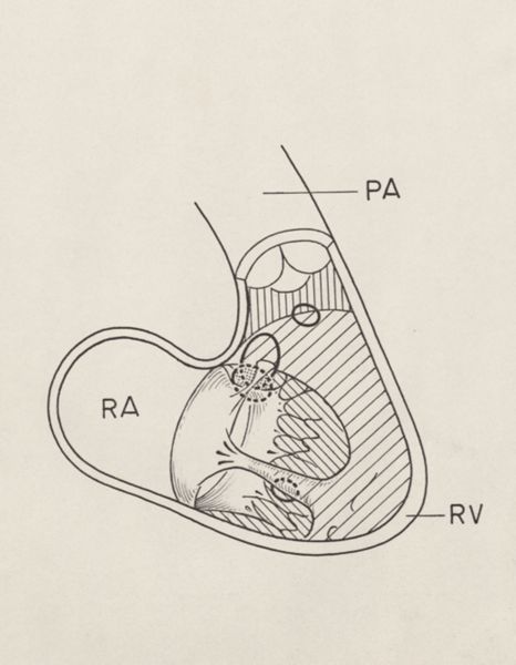 J Wetselaar-Whittaker, Cardiovascular system