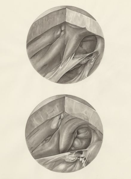 H.G Wetselaar, Two microscopic magnifications of parts of the heart