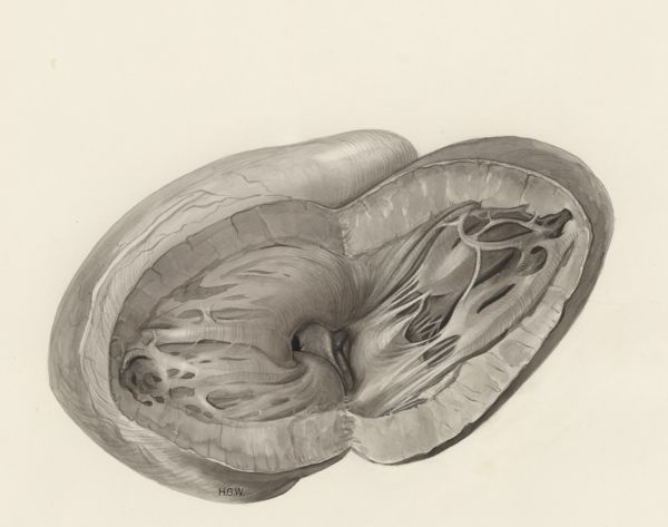 H.G Wetselaar, Heart and adjacent organs