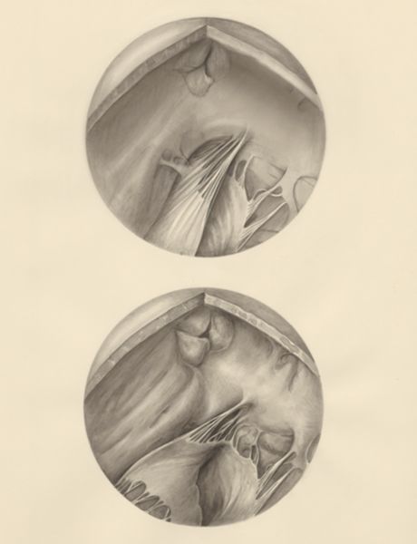 H.G Wetselaar, Two microscopic magnifications of parts of the heart