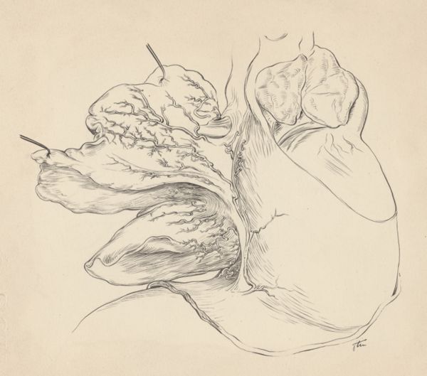 J Tinkelenberg, Part of the heart and circulatory system